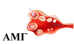 AMH baja - diagnóstico de infertilidad